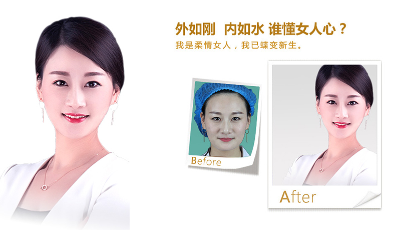 台中V脸、线雕隆鼻